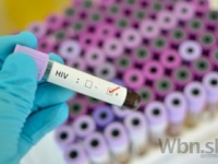 Vírus HIV sa prenáša troma hlavnými spôsobmi
