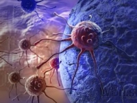 Potvrdili vyše 200-ročnú diagnózu rakoviny, porovnajú zmeny