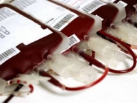 Pupočníková krv zo Slovenska pomohla pacientovi z Dallasu